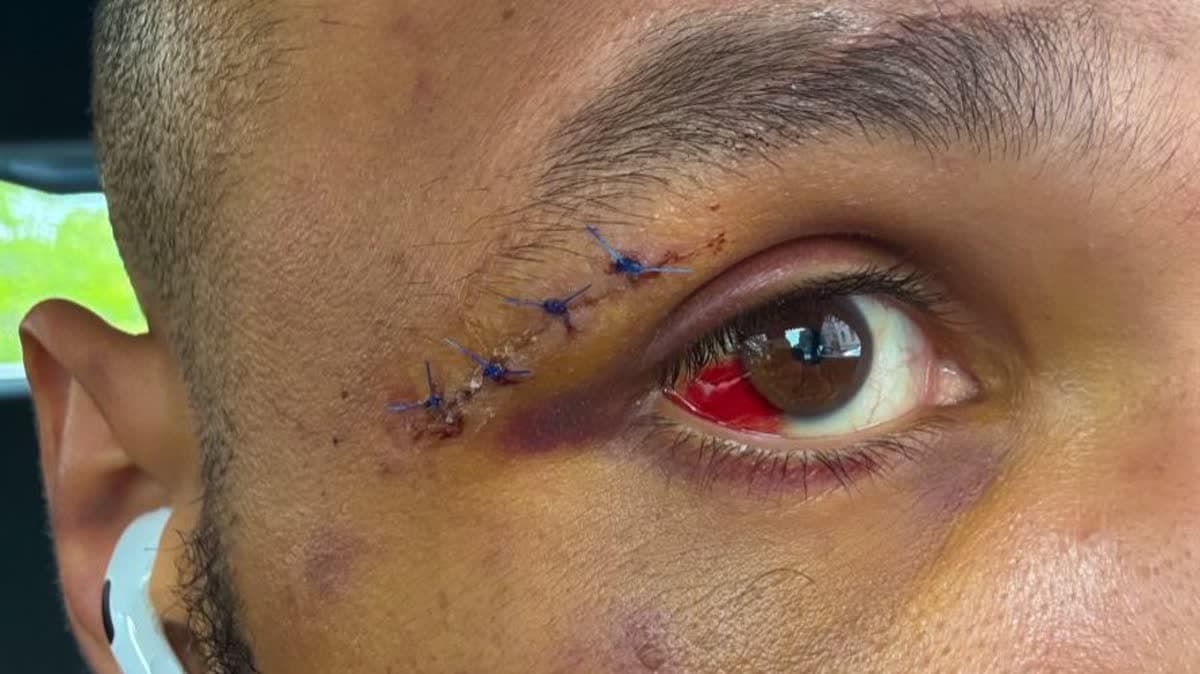 كريس يوبانك جونيور