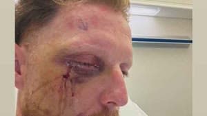 بن ستوكس مصاب