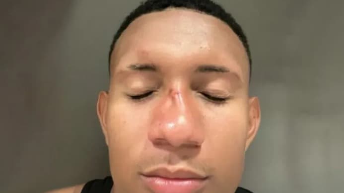 معركة بين اللاعبين