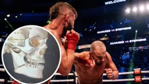 إيدي ألفاريز