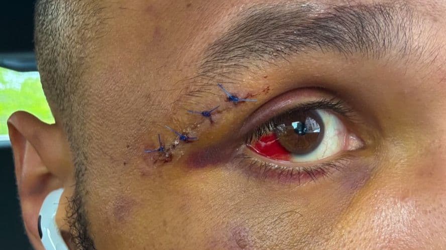 كريس يوبانك جونيور